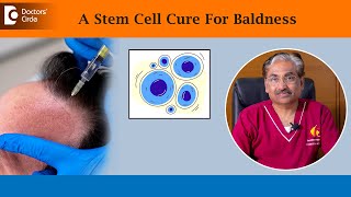 Stem Cell Treatment For Hair Loss Revolutionary Hair Therapy  DrVenkataram MysoreDoctors Circle [upl. by Moyers907]