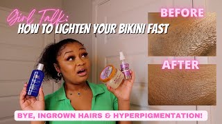 THE BEST WAYS TO LIGHTEN DARK ARMPITS DARK INNER THIGHS BIKINI AREA ELBOWS amp KNEES [upl. by Orips]