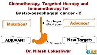 Chemotherapy Immunotherapy Targeted therapy for gastric cancer esophageal cancer Edusurg Clinics [upl. by Alicirp]