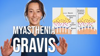 Myasthenia Gravis [upl. by Willing749]