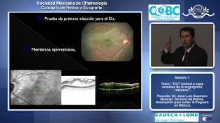 OCT normal y usos actuales de la angiografía retiniana  Dr José Luis Guerrero Naranjo [upl. by Hadria401]