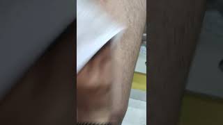 Wax skincare lipo work trending viral video viral speechviralvideos bodywax wax tips [upl. by Lambart]