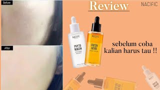 REVIEW NACIFIC  Fresh herb serum amp Phyto Niacin Essens kulit keringpori2 besar wajib coba [upl. by Leumas]