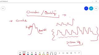 Types of PulsePulsus Paradoxus Pulsus Alternans Anacrotic Waterhammer pulse [upl. by Tarrsus]