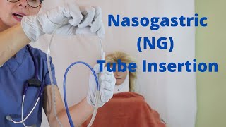 Nasogastric NG Tube Insertion [upl. by Vierno]