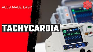 ACLS Tachycardia Algorithm [upl. by Vasquez]