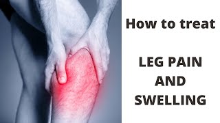 Treatment for Leg Pain and Swelling [upl. by Able799]