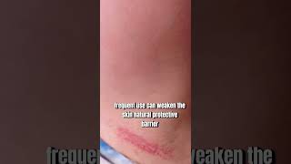 Watch This Before Using Hair Removal Creams ⚠️Dermatology Tips [upl. by Lindgren]