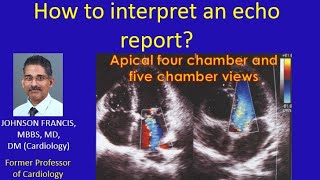 How to interpret an echo report [upl. by Annis]