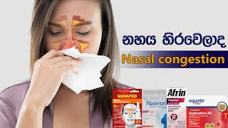 නාසය හිරවෙනවට ගන්න බෙහෙත් 😍 Nasal congestion in sinhala  nahaya hirawima [upl. by Aceissej]