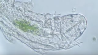 Waterbear  A Documentary about Tardigrades [upl. by Sellma]