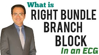 Right Bundle Branch Block RBBB ECG Interpretation Explained How to identify RBBB BlockUSMLE NEET [upl. by Amikay]