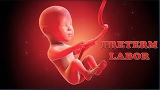 PRETERM LABOR  Define Causes Pathophysiology Diagnosis amp Management  Preterm Labor TOCOLYTICS [upl. by Ecertal309]