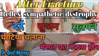 reflex sympathetic dystrophy  reflex sympathetic dystrophy treatment  RSD treatment  in hindi [upl. by Saks]