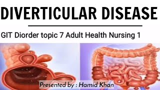 Diverticular diseases in Urduhindidiverticular bleedingdiverticulitisdiverticulitis in UrduBSN [upl. by Noyerb149]