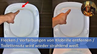 Flecken  Verfärbungen von Klobrille entfernen  Toilettensitz wird wieder strahlend weiß [upl. by Ddahc865]