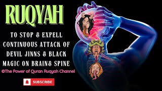 Ultimate Ruqyah to Stop amp Expell the Continuous Attack of Devil Jinns amp Black Magic on Brain amp Spine [upl. by Miuqaoj]