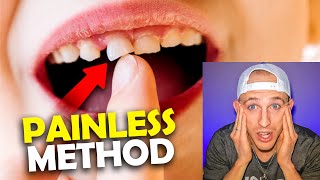 How to Pull Out a Loose Tooth at Home Without Pain in 5 Steps [upl. by Oesile216]