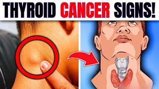 10 WARNING Signs Of Thyroid Cancer You Must Not IGNORE [upl. by Aihceyt873]