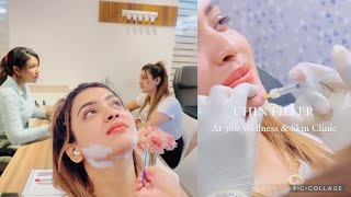 Chin filler කරලා තියෙනවද කරලා බලන්න ආස හිතෙයි 😍☺️ ​⁠ 360beautysl Doctor’s number 0117550099 [upl. by Eniluqaj]