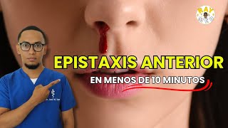 Epistaxis Anterior explicado fácilmente  ORL [upl. by Gans]