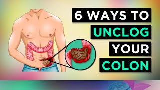 6 Ways To CLEAR Your CONSTIPATION [upl. by Booze]