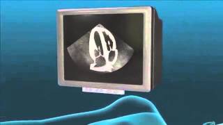 Echocardiogram Animation [upl. by Beichner]