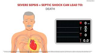 The Effects of Sepsis [upl. by Sheela]