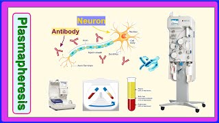 plasmapheresis [upl. by Sima]