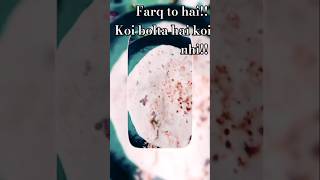 Farq to hai 🧐🙃easy way to 🤏cook loki kofte recepie youtubeshorts emotionalstatusjayajoshi4765 [upl. by Donelle178]