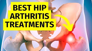 The Best Hip Arthritis Treatments Without Surgery [upl. by Adnohs122]