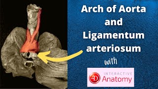 Arch of Aorta  Branches  Relations  Ligamentum arteriosum  Dr Doris [upl. by Sherborne]