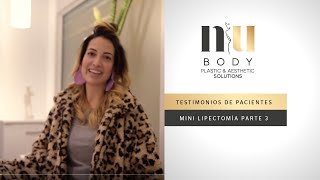 Testimonio de Minilipectomía y Liposucción NuBody  Parte 3 [upl. by Iva]