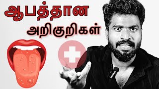 DANGEROUS SIGNS  உடம்பில் ஏற்படும் அறிகுறிகளை உடனே கவனியுங்கள்  Machi Tea Sollu [upl. by Aryn820]