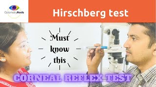 Hirschberg Test II Corneal light reflex test [upl. by Haras]