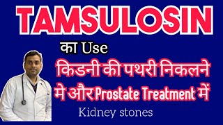 Tamsulosin for Ureteric calculus treatment  peshab ki nali me stone vuj calculus kidney urinary [upl. by Karole]