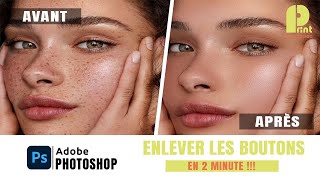 Comment Enlever les Boutons avec Photoshop [upl. by Mindy]