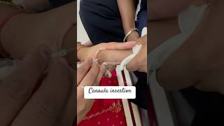 Cannula insertion of 5 month old child nurses doctor cannula youtubeshorts ytshorts shorts [upl. by Anomahs]