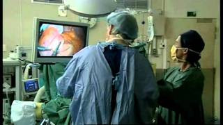 3 Live Gastric Banding Procedure Demonstration [upl. by Yanaton]