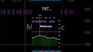 Medtronic невагайся підключайся [upl. by Rafaelita]