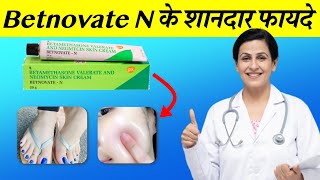 Betnovate N Cream Review in Hindi फायदे नुकसान व उपयोग विधि  Betnovate N से गोरा बने [upl. by Boothman]