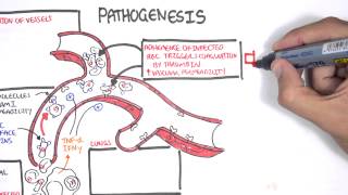 Malaria Pathophysiology [upl. by Sido]