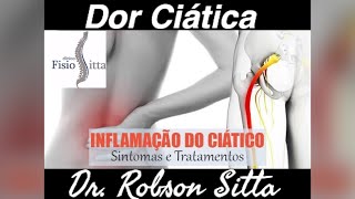 CIATALGIA CUIDADO DOR CIÁTICA NÃO É TUDO IGUAL Clínica de Fisioterapia Dr Robson Sitta [upl. by Arakawa]