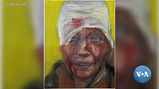 Face of Olena Kurilo – Bloodied Symbol of Russia’s Attack on Ukraine [upl. by Yuji550]