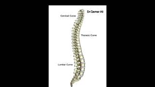 Scheuermann’s disease causes symptom diagnosis xray treatment [upl. by Duvall356]