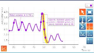 Spirometer Part 2 [upl. by Lisbeth]