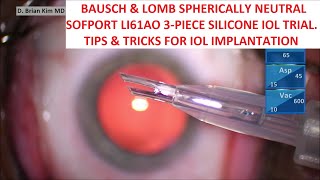 Bausch amp Lomb Sofport LI61AO Trial Tips amp Tricks for Easy amp Consistent IOL Implantation [upl. by Terej]