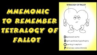 MNEMONIC TO REMEMBER TETRALOGY OF FALLOT [upl. by Teddman]