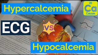 ECG Changes in Hypercalcemia vs Hypocalcemia The Cardiac Consequences of Calcium Imbalances [upl. by Kirit381]