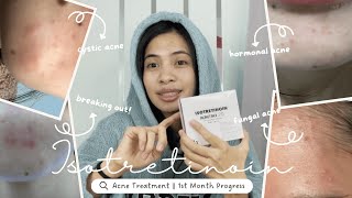 Accutane Journey  One Month Progress Road to Clear Skin [upl. by Annoya]